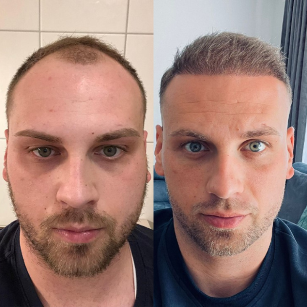 imgpsh_fullsize_anim – 2023-12-14T105858.081