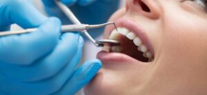 dental procedures, dental treatment, dental care