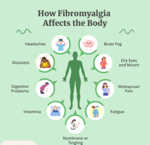 fibromyalgia