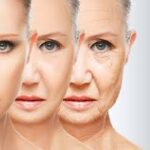 facelift