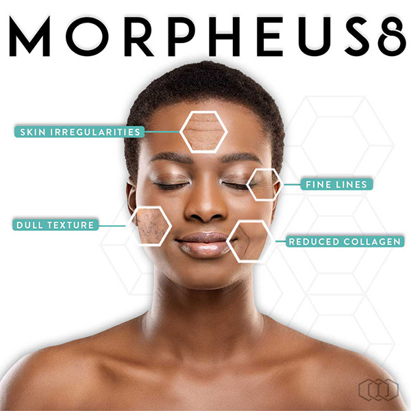 morpheus8